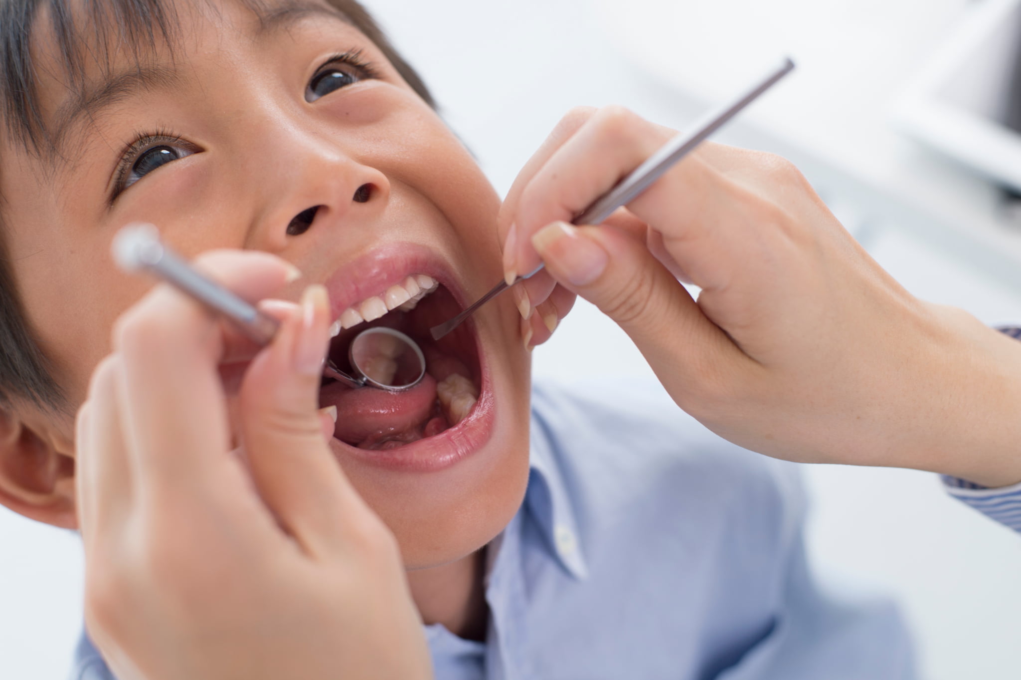 歯科医院で受けられる子どもの虫歯予防ケアの様子