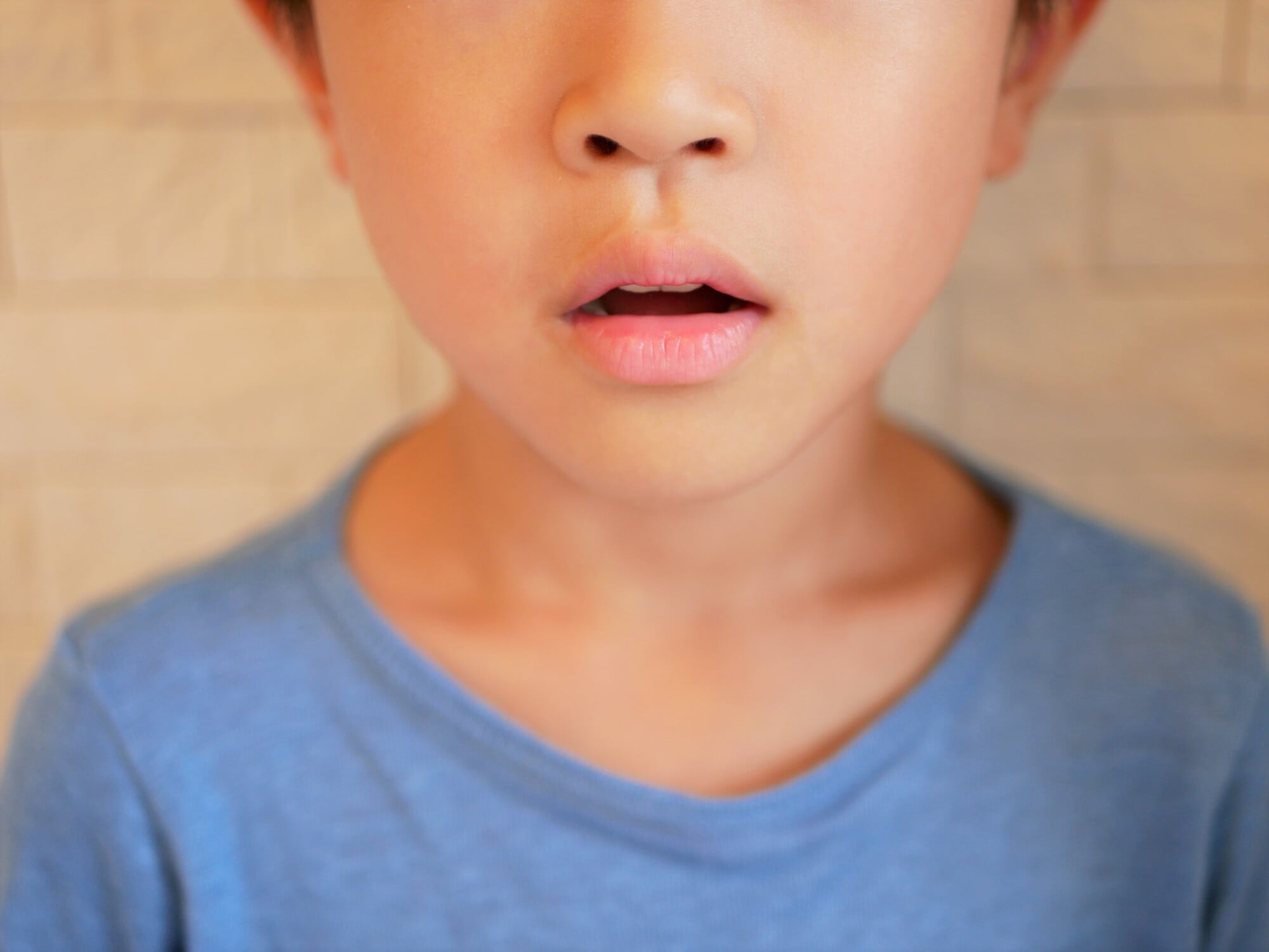 口呼吸をしている子どもの口のイメージ