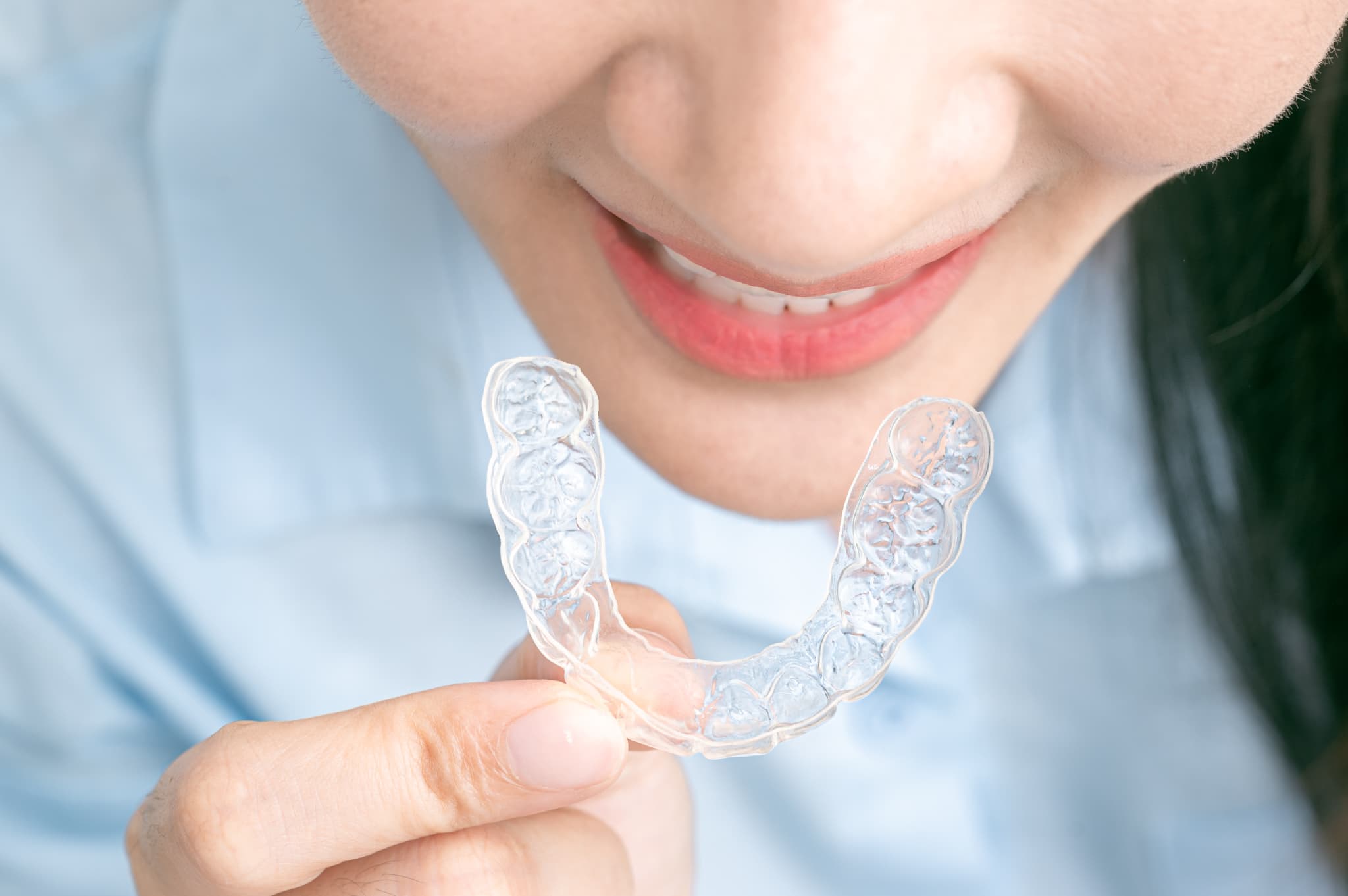 インビザラインを装着する様子