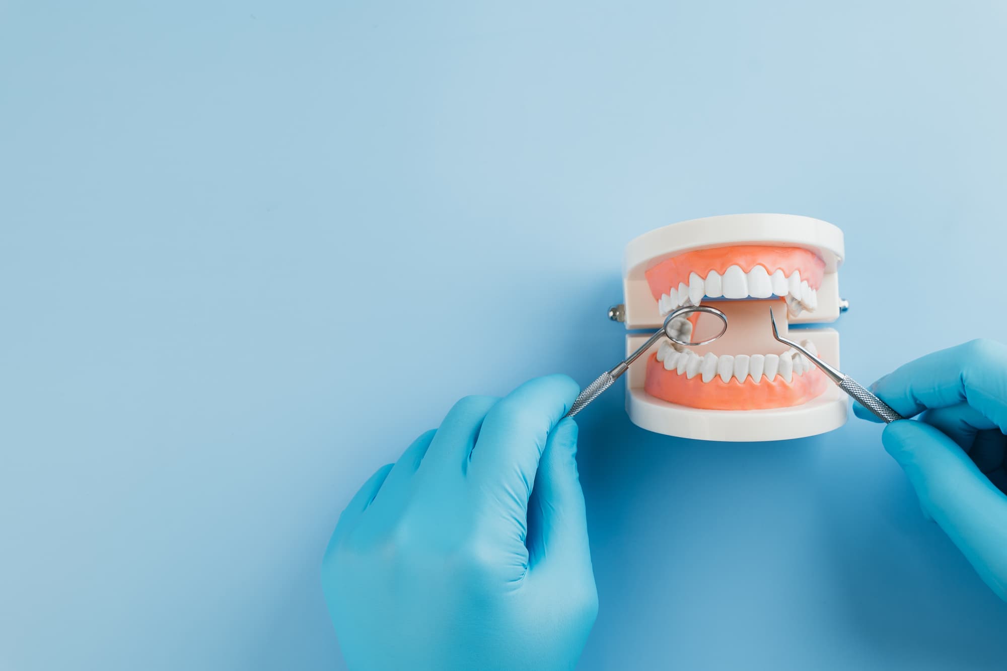 歯科検診をする歯科医師のイメージ